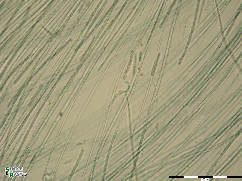 Nostochopsis lobatus