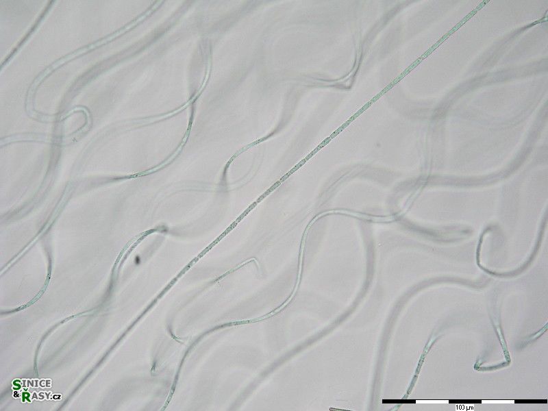 Nostochopsis lobatus