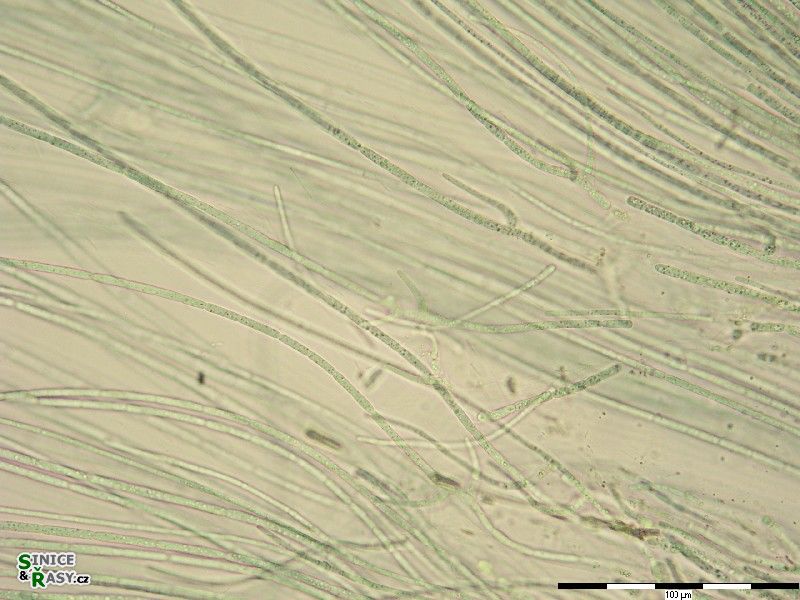 Nostochopsis lobatus