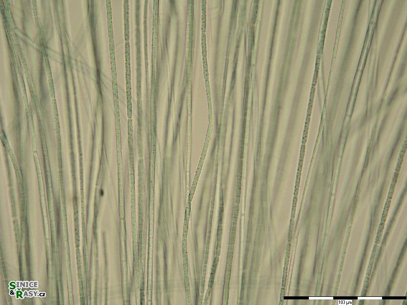 Nostochopsis lobatus