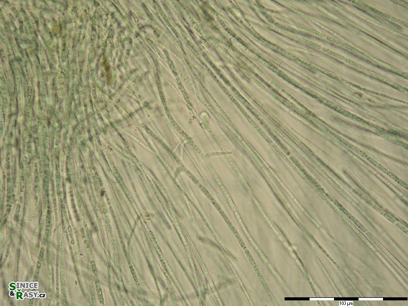 Nostochopsis lobatus