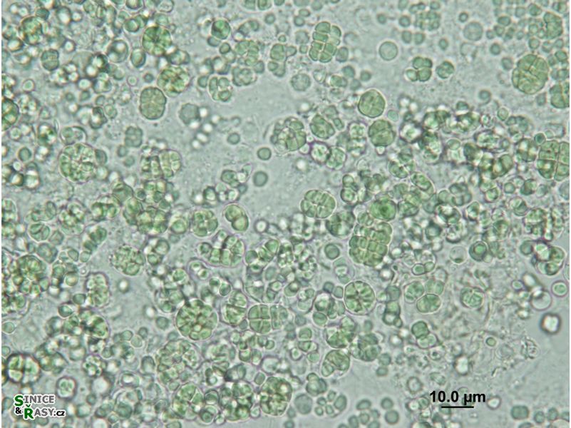 Chroococcidiopsis thermalis