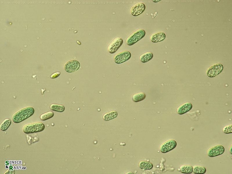 Cyanothece aeruginosa