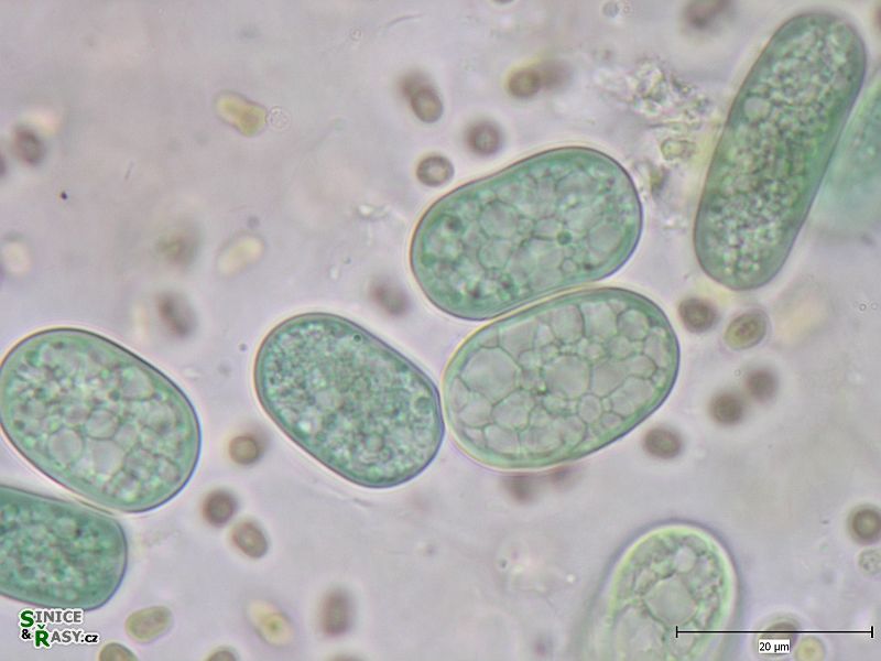 Cyanothece aeruginosa