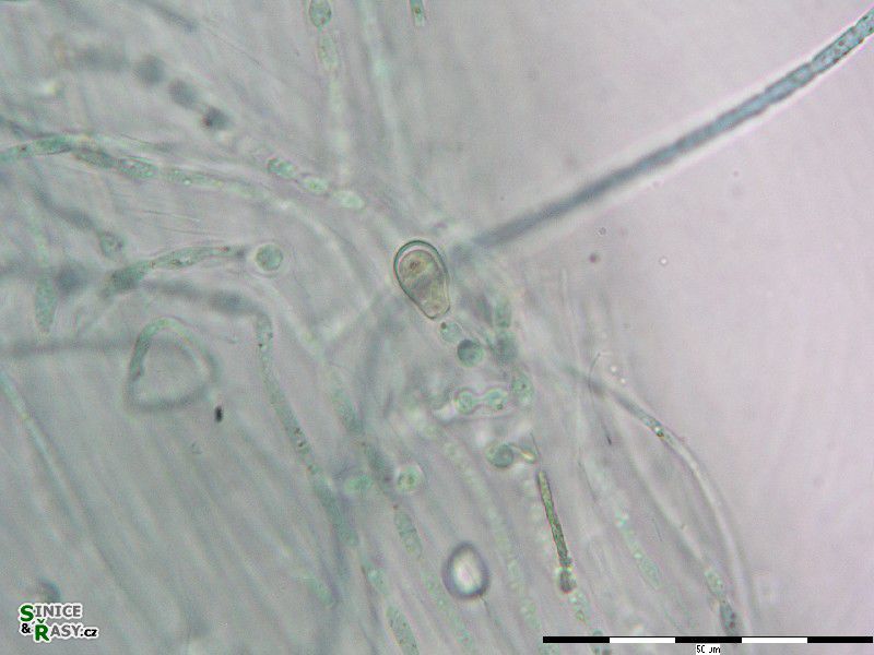 Nostochopsis lobatus