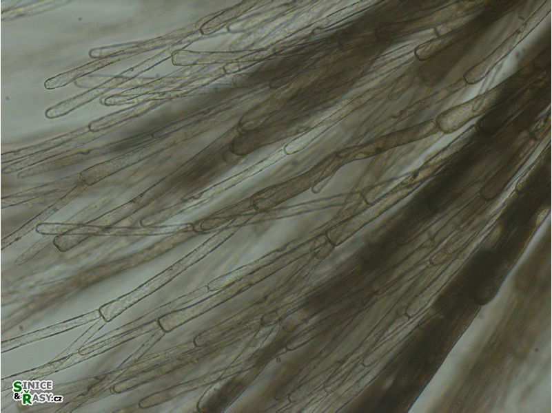 Wrangelia penicillata