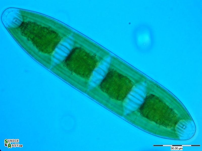 Planotaenium interruptum