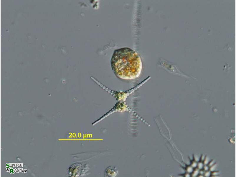 Staurastrum planctonicum