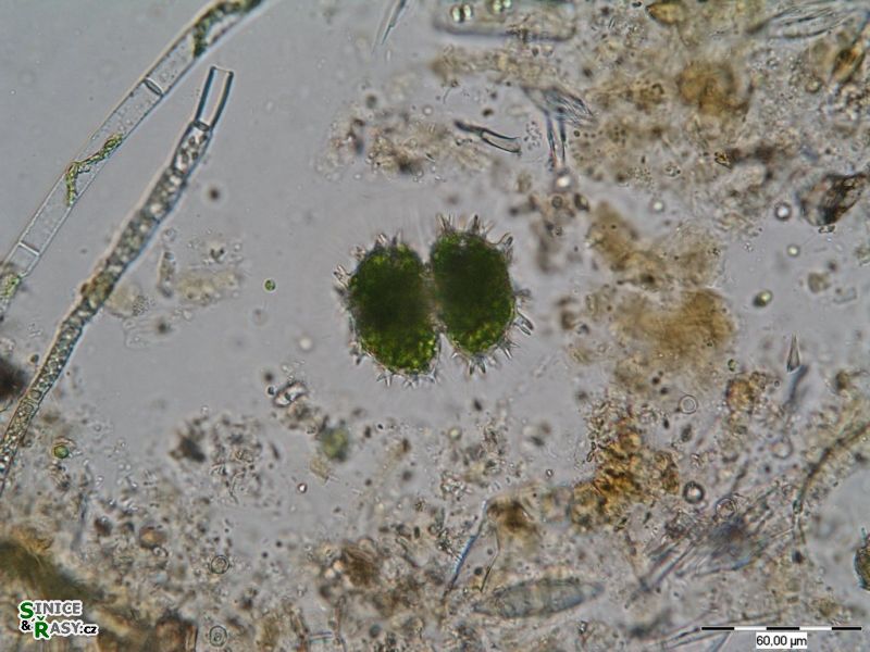 Staurastrum spongiosum