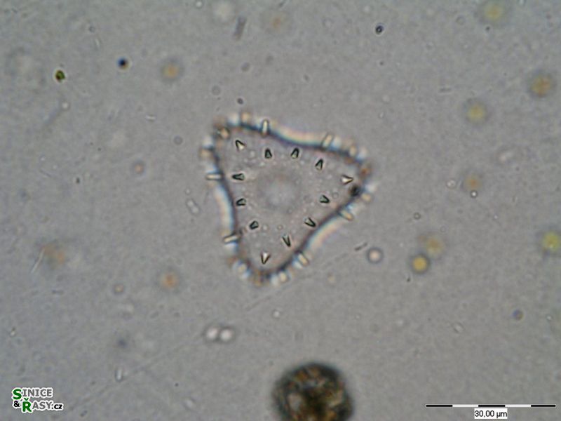 Staurastrum teliferum