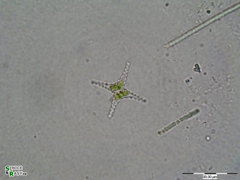 Staurastrum tetracerum