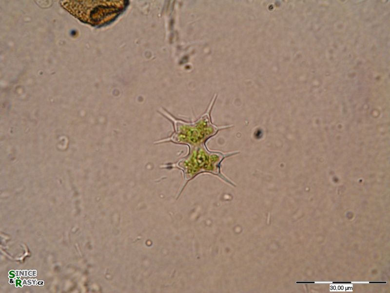 Xanthidium octocorne