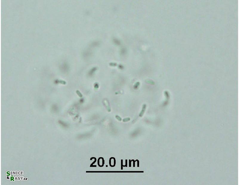 Cyanodictyon planctonicum
