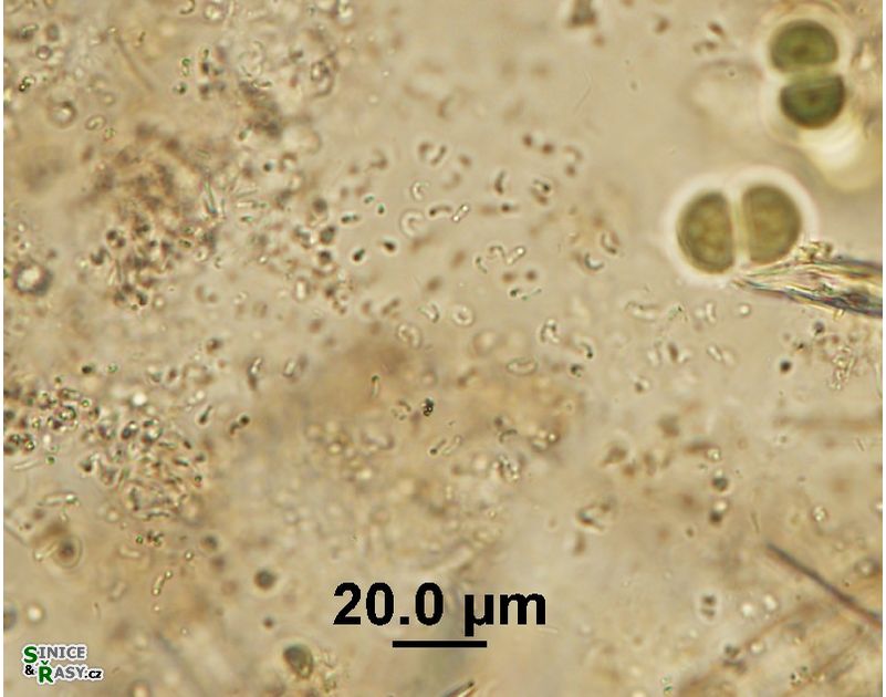 Rhabdoderma vermiculare