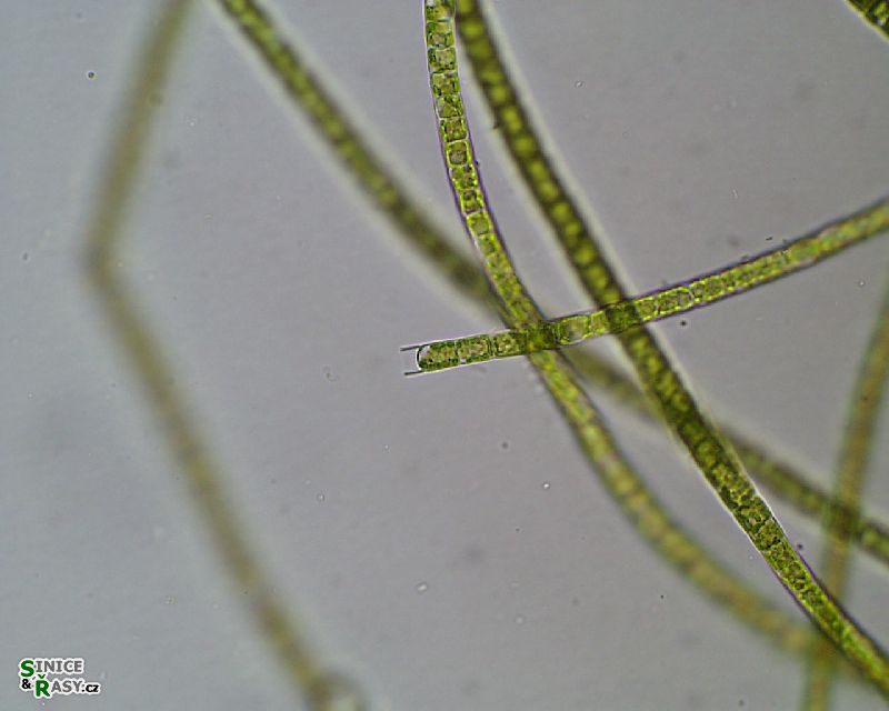 Microspora sp.