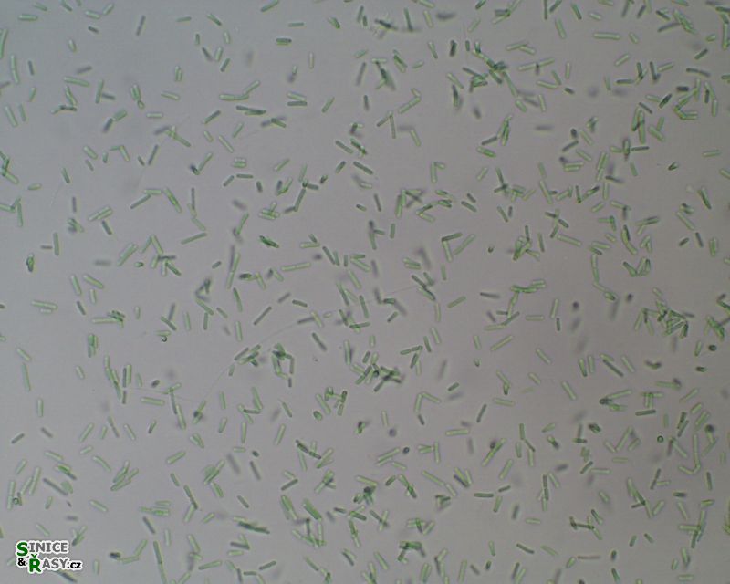 Synechococcus bigranulatus