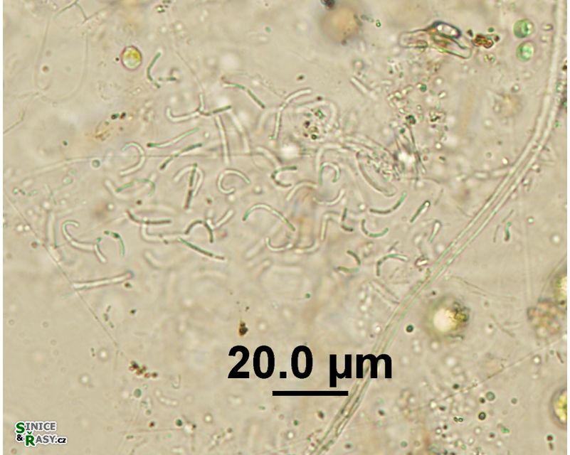 Rhabdoderma vermiculare