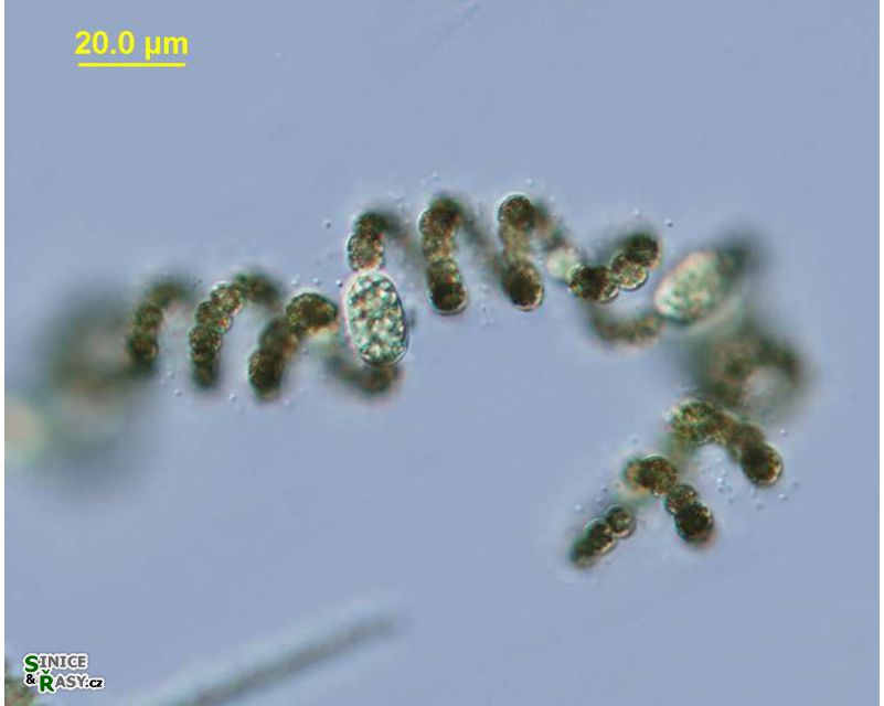Dolichospermum spiroides