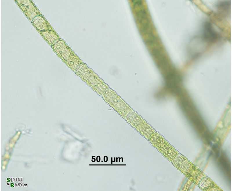 Oedogonium undulatum