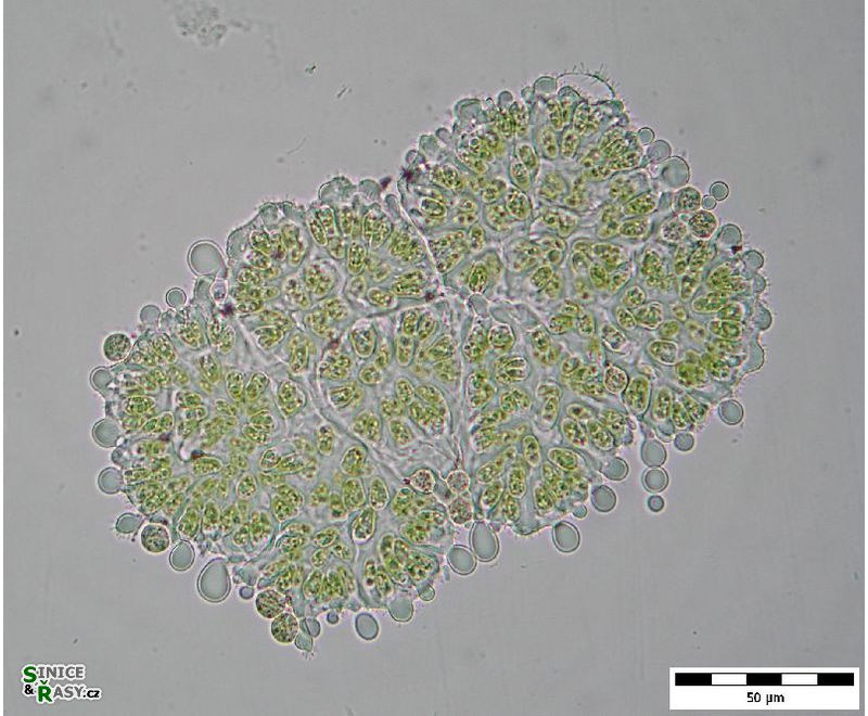 Botryococcus braunii 