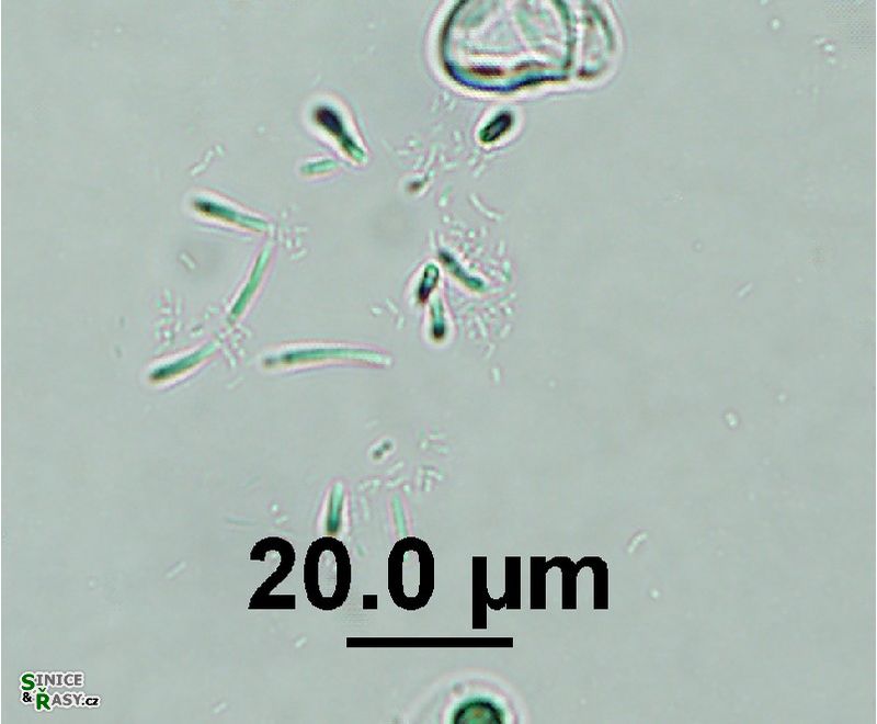 Rhabdoderma vermiculare