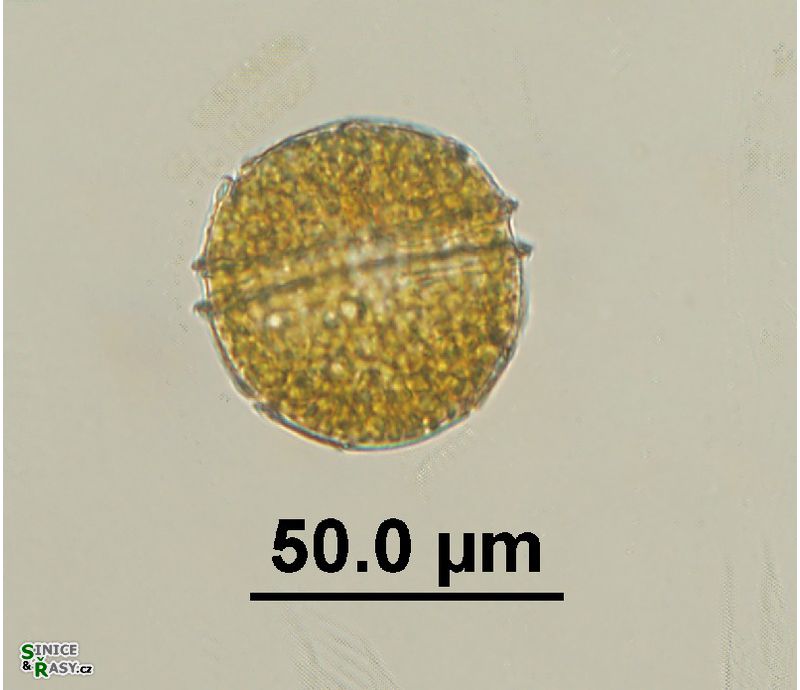 Peridinium sp. 