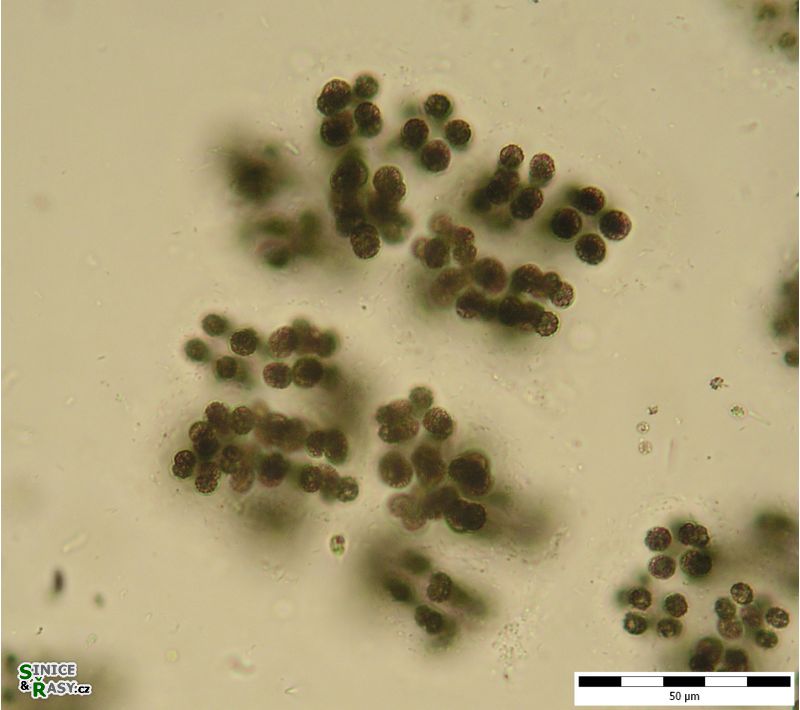 Microcystis viridis