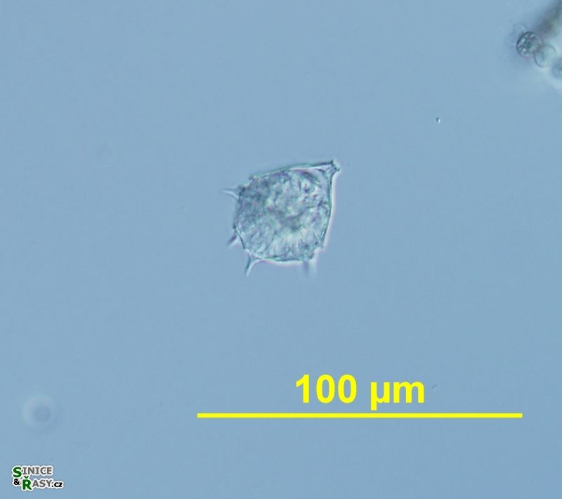 Parvodinium cunningtonii