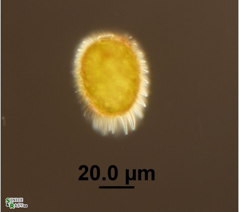 Trachelomas bituricensis