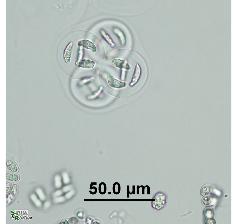 Nephrocytium limneticum
