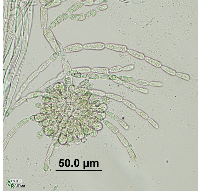 Batrachospermum gelatinosum