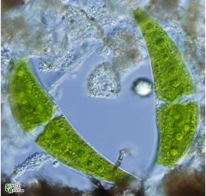 Closterium moniliferum