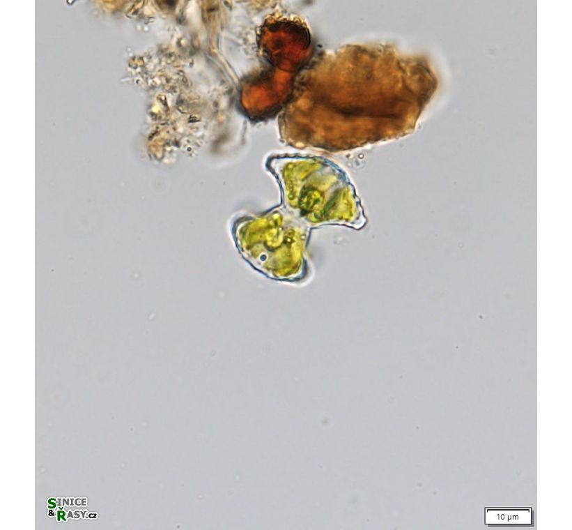 Staurastrum margaritaceum