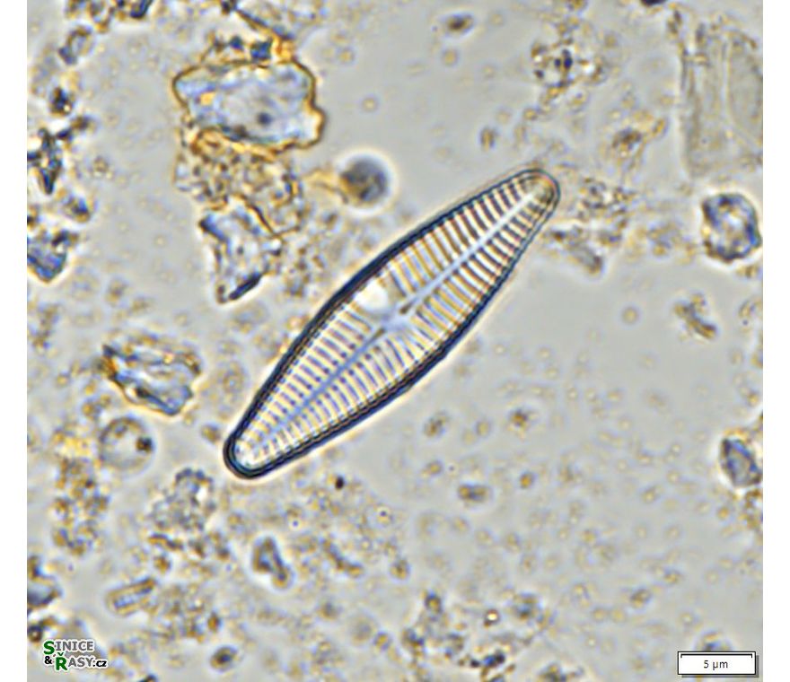 Planothidium lanceolatum