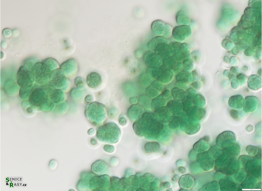 Chroococcidiopsis thermalis