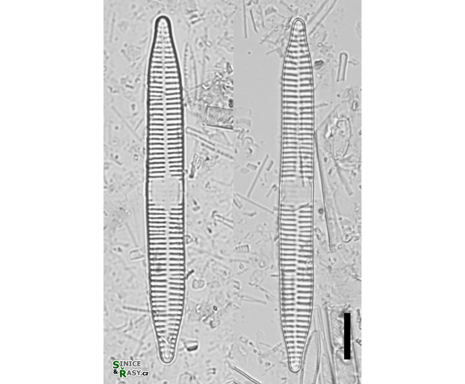 Ulnaria ulna