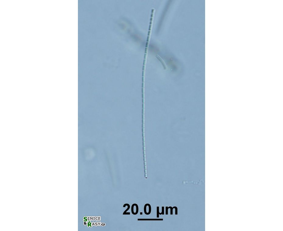 Pseudanabaena frigida