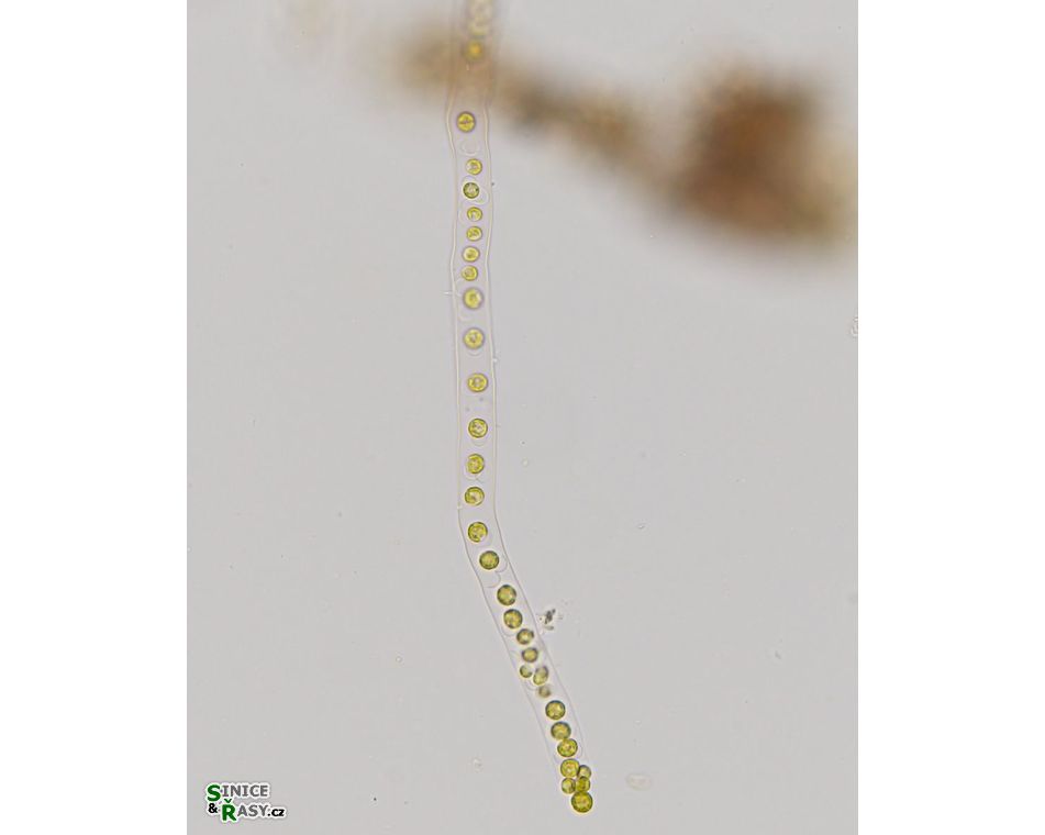 Palmodictyon varium