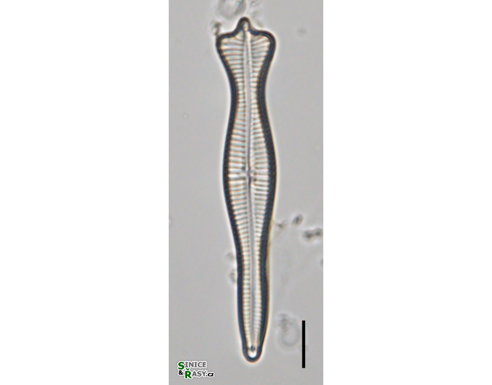Gomphonema coronatum